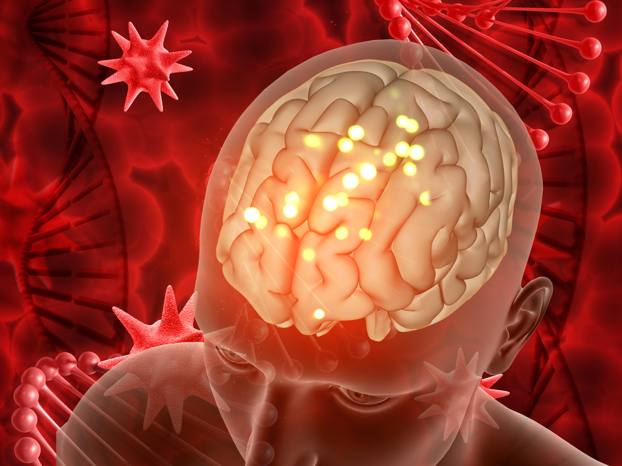 Brain Arteriovenous Malformation