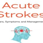 Acute Stroke