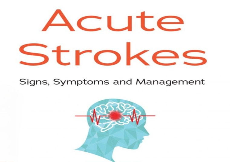 Acute Stroke