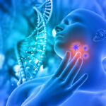 carotid artery stenosis