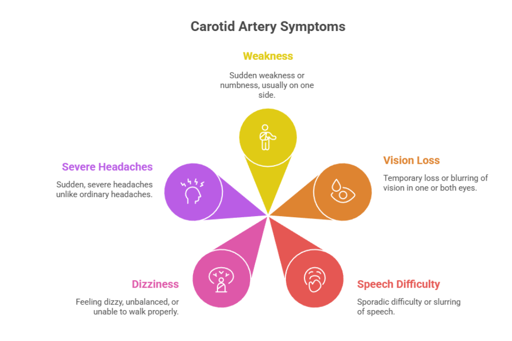 Carotid Artery Stenosis: Symptoms, Causes & Treatments