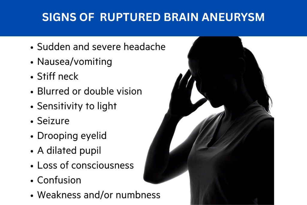 Ruptured Brain Aneurysm: Symptoms Causes And Treatment