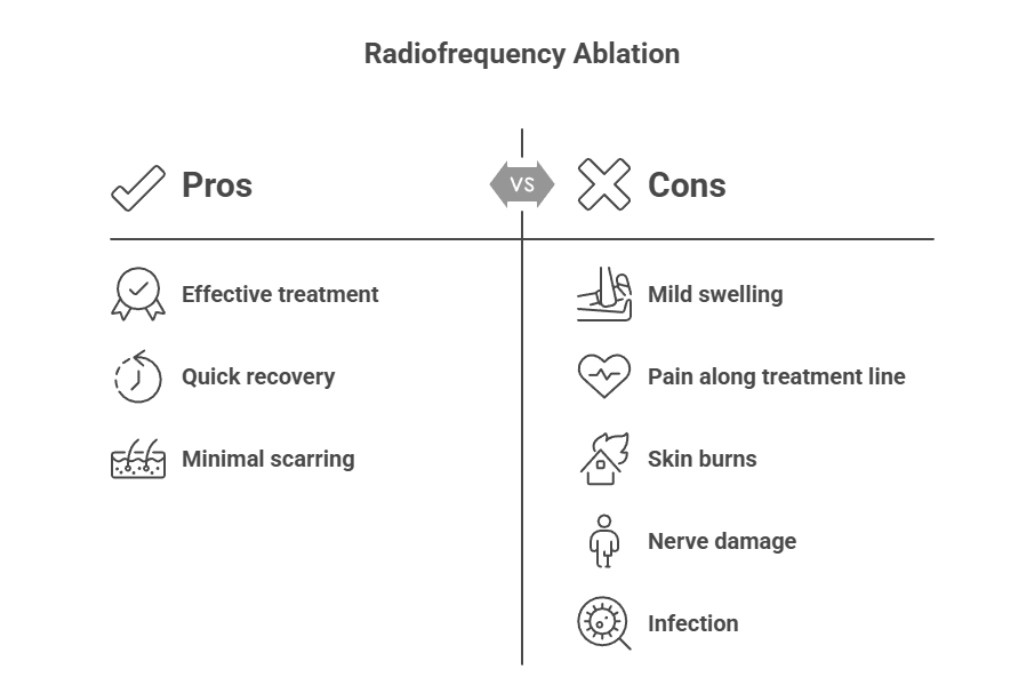 Radiofrequency Ablation: Fast Relief for Varicose Veins

