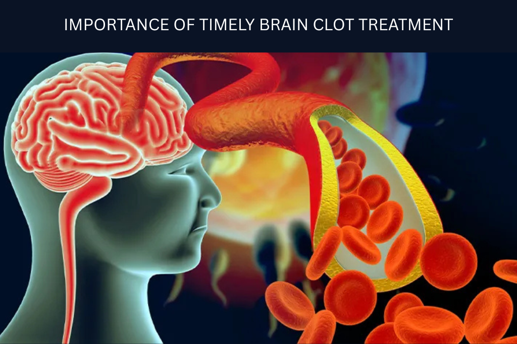 Advanced Brain Blood Clot Treatment Options in Faridabad