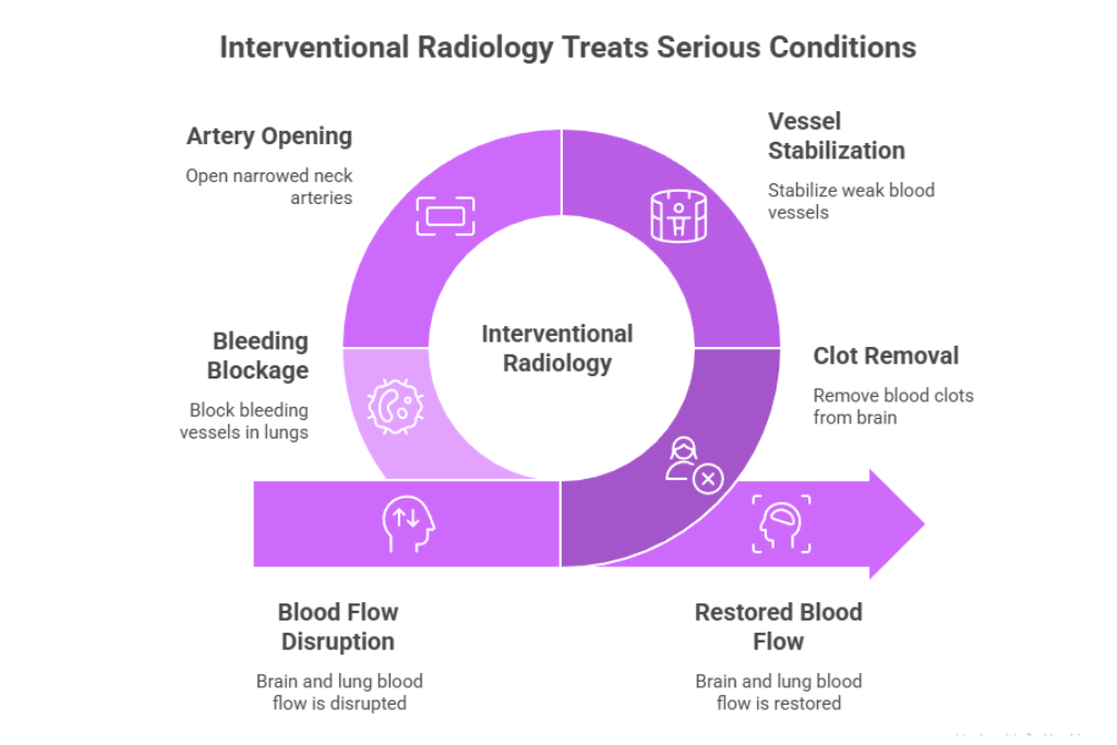 Interventional Radiology: Advanced Care Without Surgery