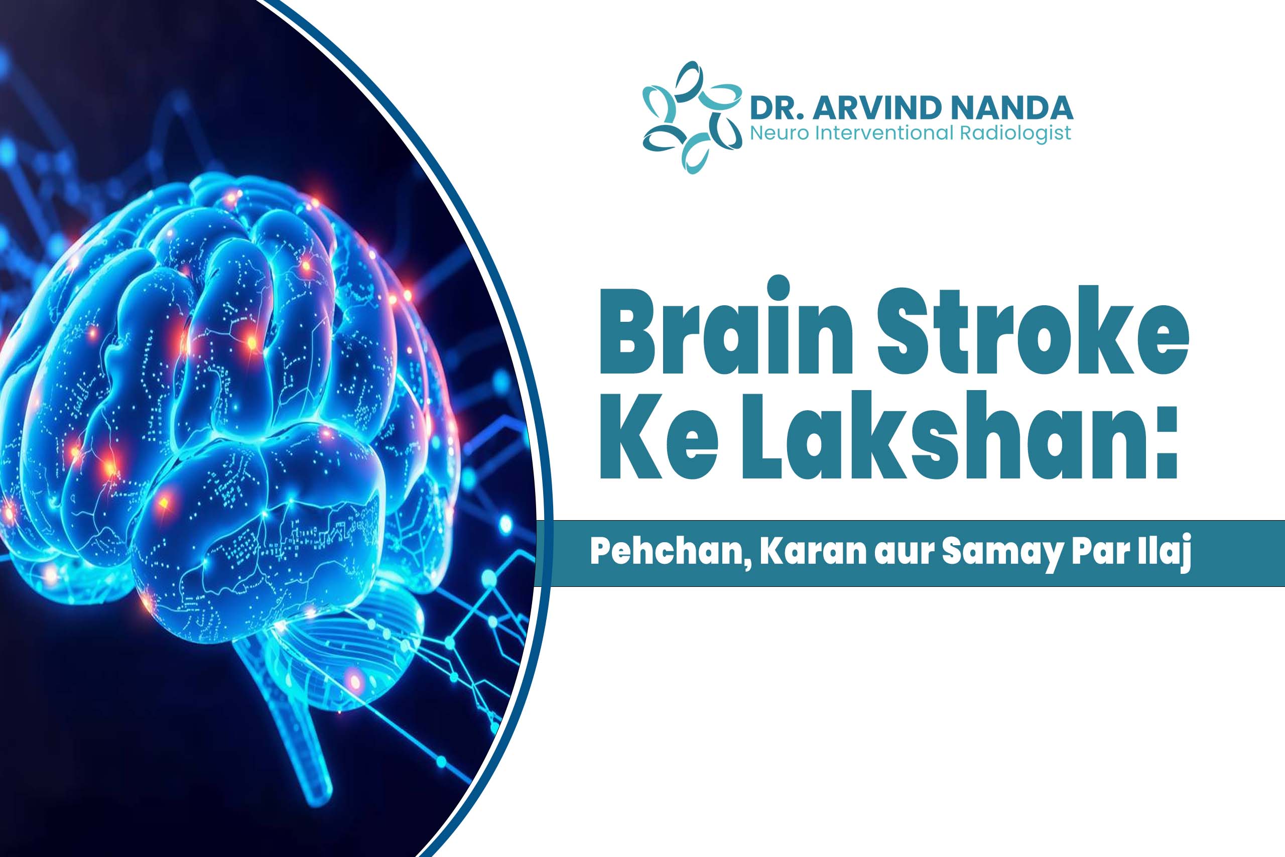 Brain Stroke Ke Lakshan: Pehchan, Karan aur Samay Par Ilaj