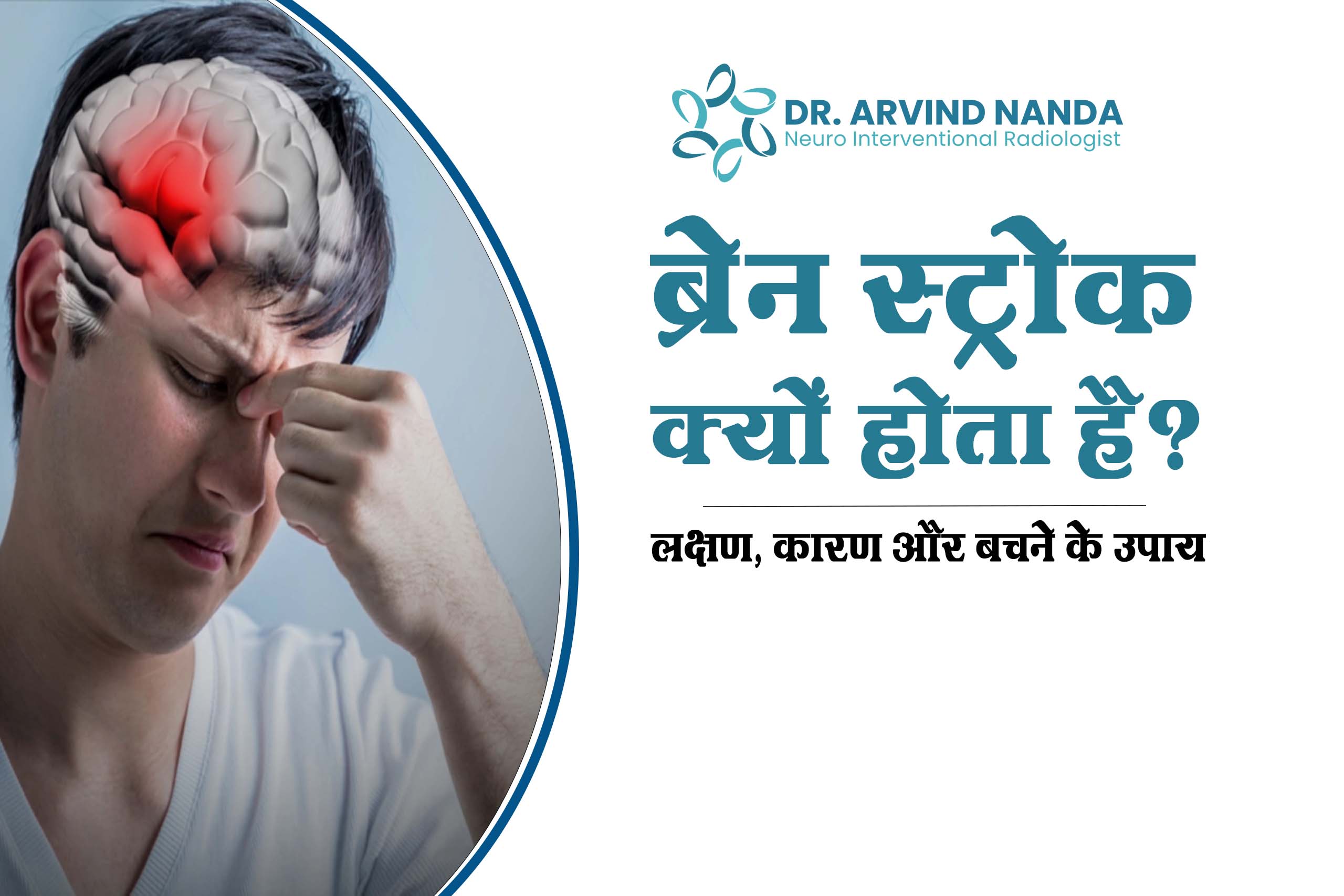 ब्रेन स्ट्रोक क्यों होता है | लक्षण, कारण और बचने के उपाय