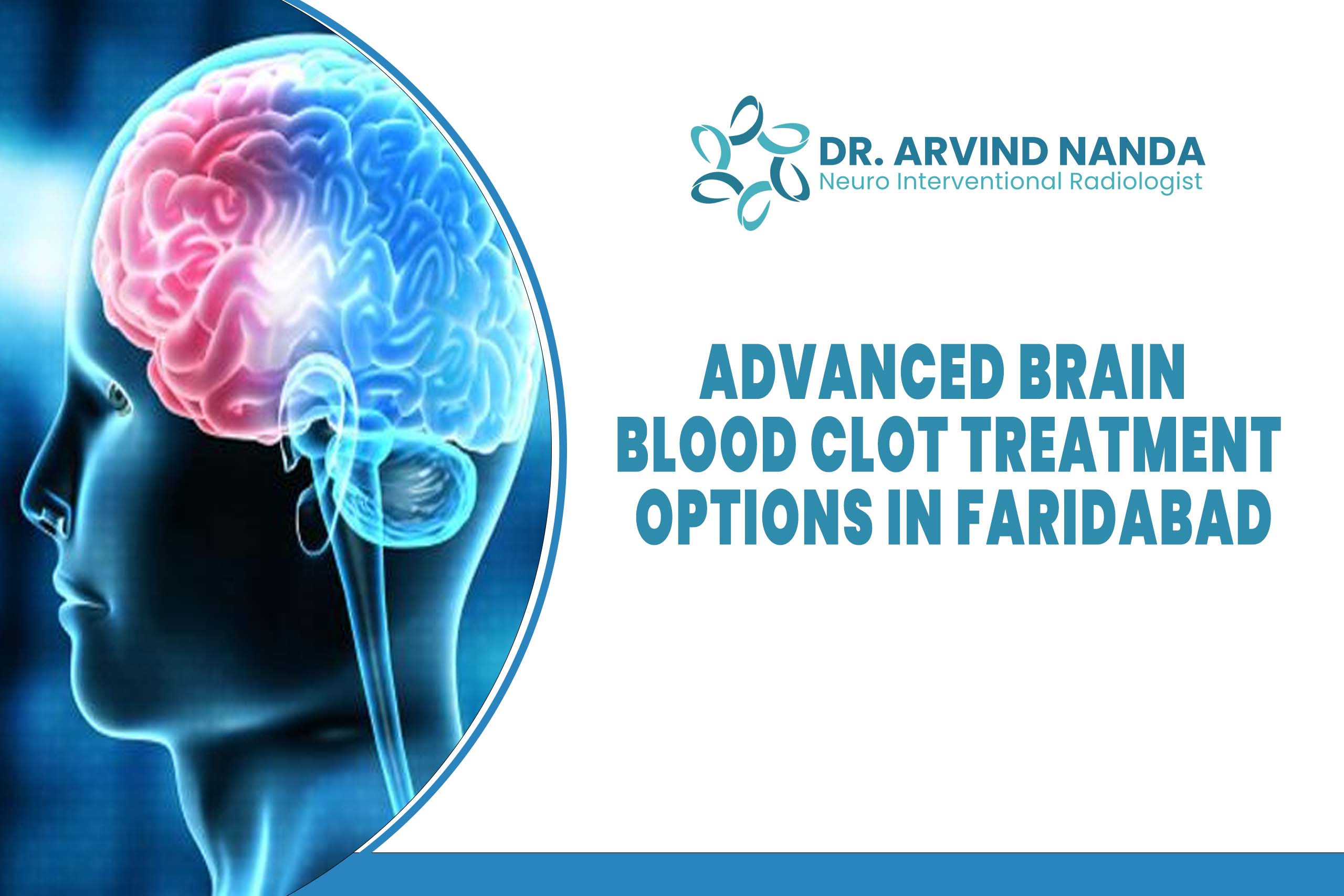 Advanced Brain Blood Clot Treatment Options in Faridabad